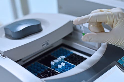 Pena Infectado ¿Cómo se detecta si un paciente está infectado por coronavirus? - La ...